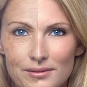 Wrinkle & Anti-aging Surgery 